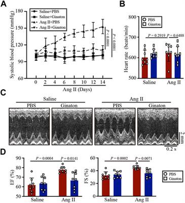 Ginaton reduces M1-polarized macrophages in hypertensive cardiac remodeling via NF-κB signaling